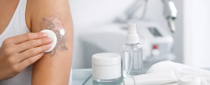 Laser Tattoo Removal Aftercare Steps