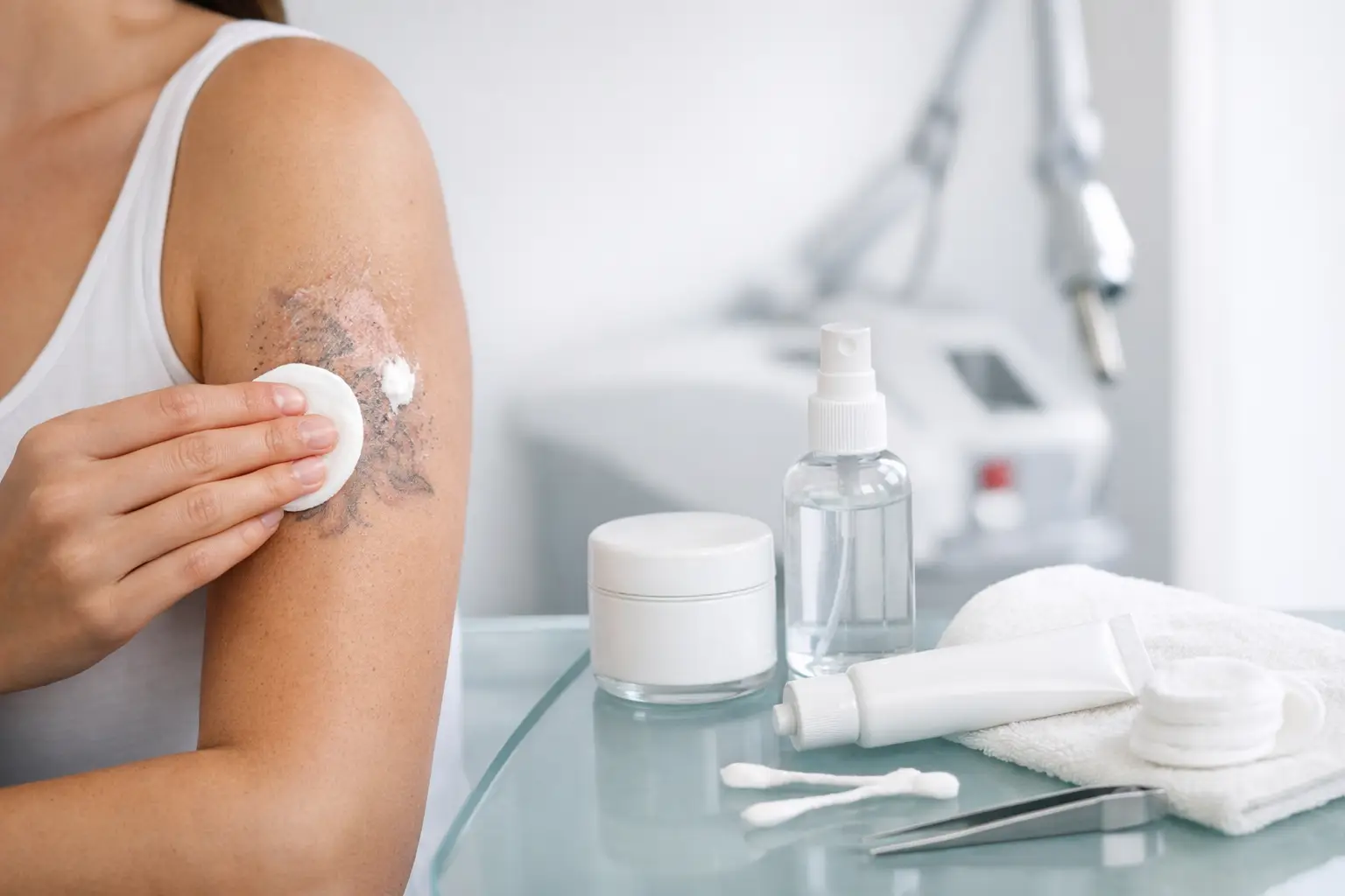 Laser Tattoo Removal Aftercare Steps