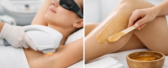 IPL Versus Waxing Sunshine Coast: Which Suits You?